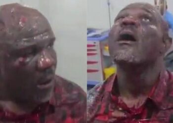 Tempo Mudi badly bruised for singing the praises of President Bola Ahmed Tinubu