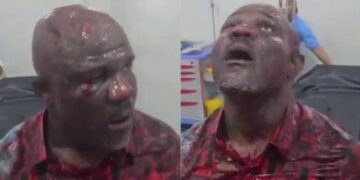 Tempo Mudi badly bruised for singing the praises of President Bola Ahmed Tinubu