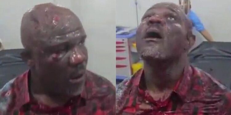 Tempo Mudi badly bruised for singing the praises of President Bola Ahmed Tinubu