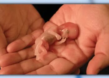 Baby, Abortion, Unborn