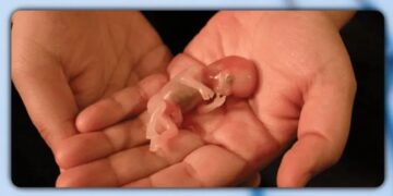 Baby, Abortion, Unborn