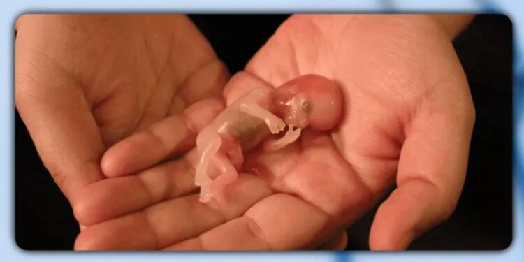 Baby, Abortion, Unborn