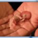 Baby, Abortion, Unborn