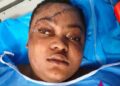 Ugochukwu (Ugochi) Nwabugo in a hospital bed