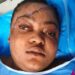 Ugochukwu (Ugochi) Nwabugo in a hospital bed