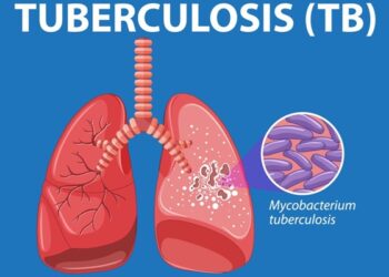 Tuberculosis